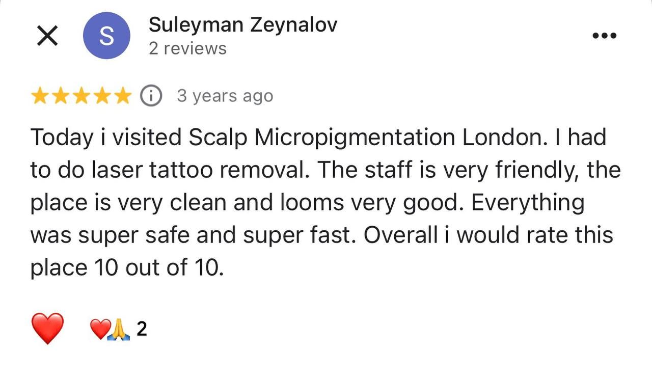 Google review from Suleyman Zeynalov for Scalp Micropigmentation London